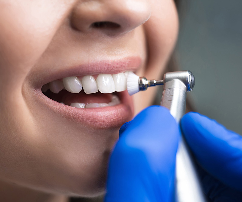 Dental Hygiene/Teeth Cleaning