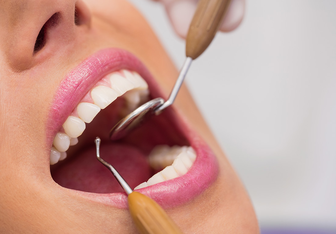 Laser Gum Depigmentation