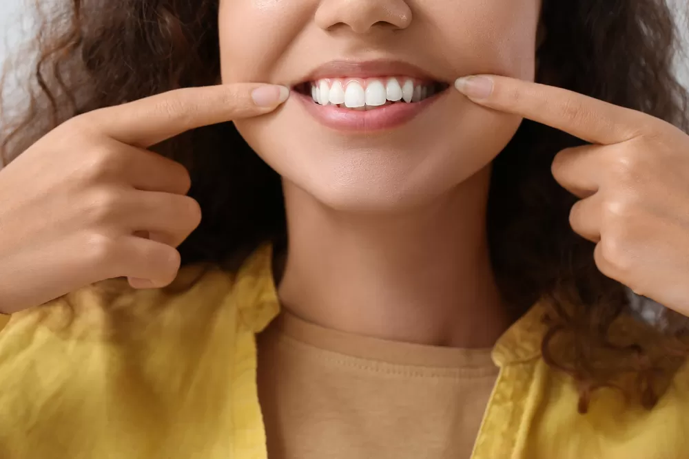Tips On Maintaining Results After Gum Depigmentation Treatment