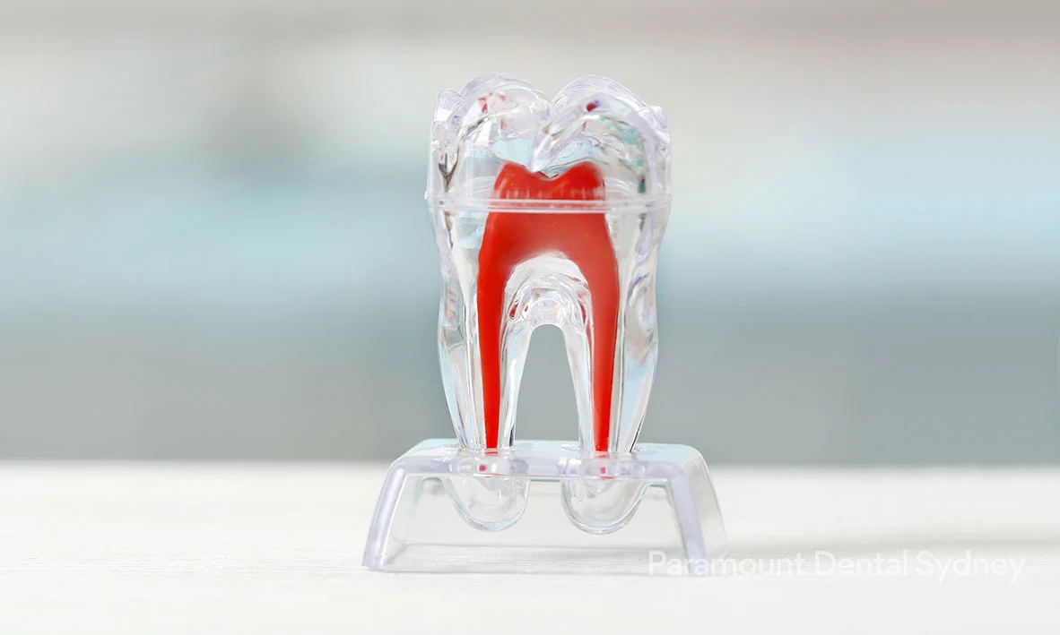 Pulpotomy