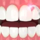 next thumbnail
