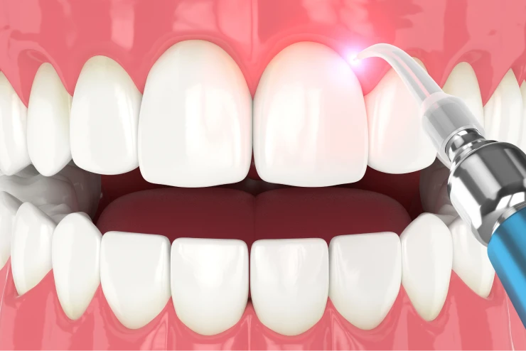 Cosmetic Dentistry