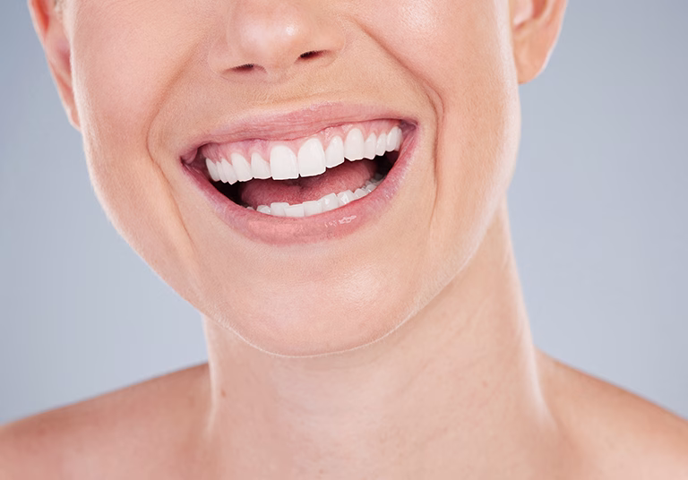 Laser Gum Depigmentation